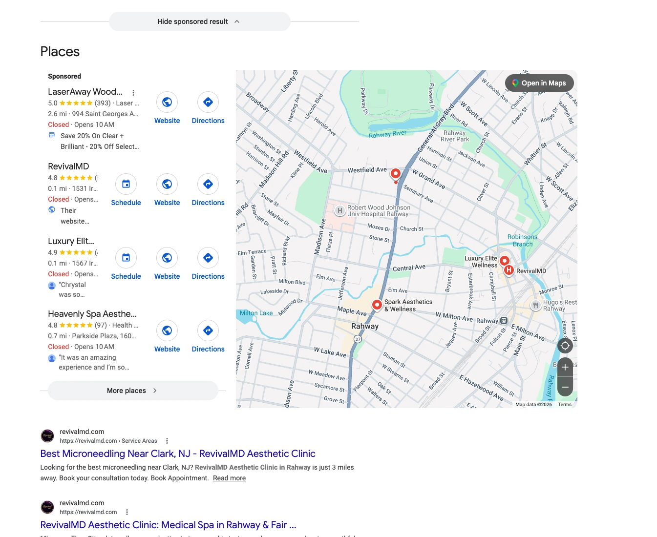 Classic Google (Map Pack + Organic) response citing RevivalMD for microneedling for acne scars rahway nj